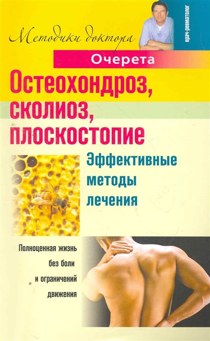 

Остеохондроз сколиоз плоскостопие Эффект методы лечения