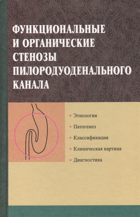 

Функциональные и органические стенозы пилородуоденального канала