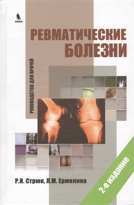 Стрюк Р., Ермолина Л., Ревматические болезни Руководство для врачей 2-е издание Стрюк Р., Ермолина Л., Ревматические болезни Руководство для врачей 2-е издание