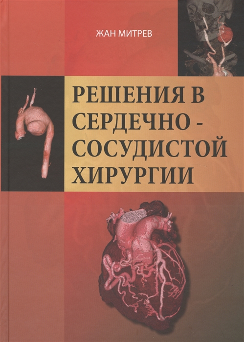 

Решения в сердечно-сосудистой хирургии