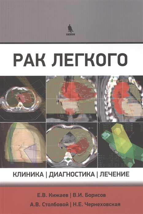 Кижаев Е., Борисов В., Столбовой А., Чернеховская Н. - Рак легкого клиника диагностика лечение