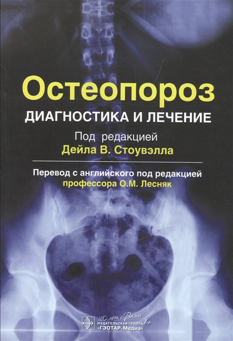 Остеопороз. Диагностика и лечение