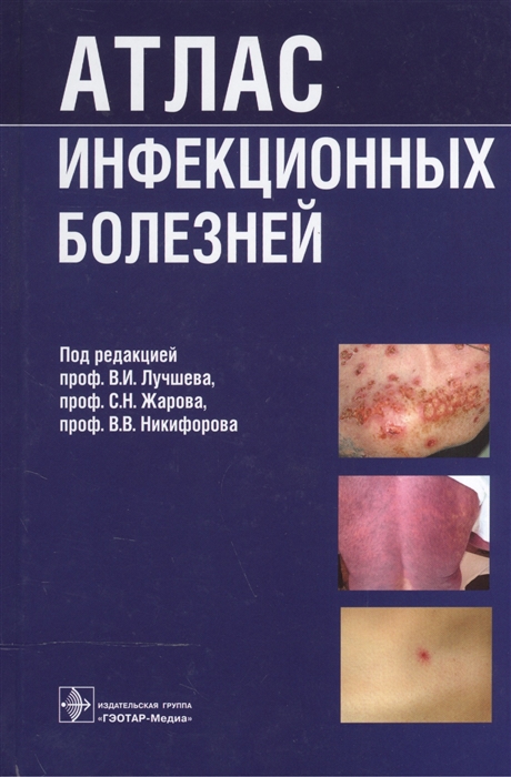 

Атлас инфекционных болезней учебное пособие