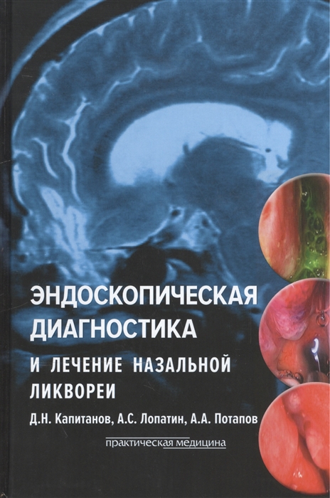 

Эндоскопическая диагностика и лечение назальной ликвореи