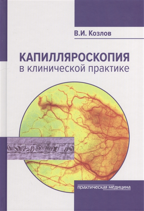 

Капилляроскопия в клинической практике