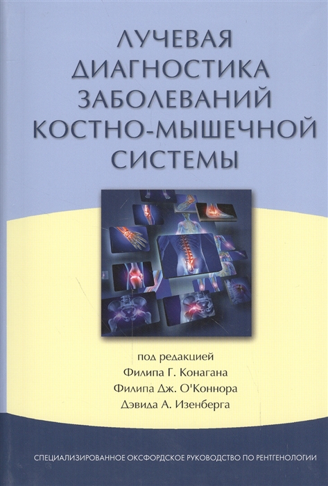 

Лучевая диагностика заболеваний костно-мышечной системы