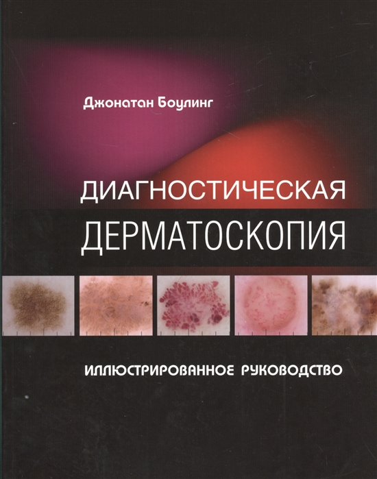 

Диагностическая дерматоскопия Иллюстрированное руководство