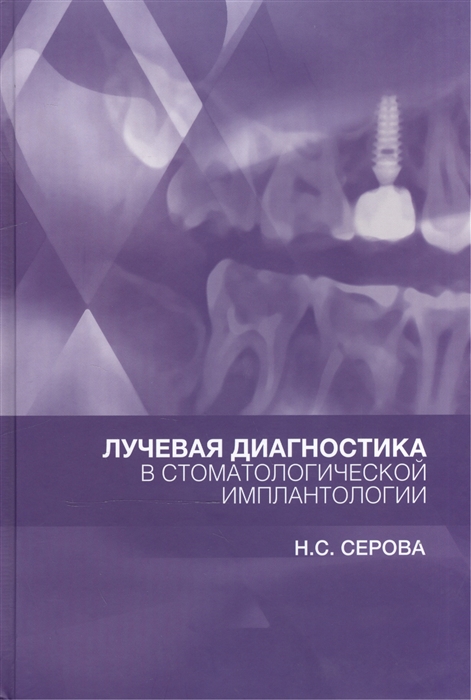 

Лучевая диагностика в стоматологической имплантологии