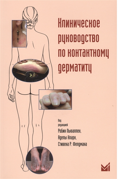 

Клиническое руководство по контактному дерматиту Диагностика и лечение в зависимости от области поражения