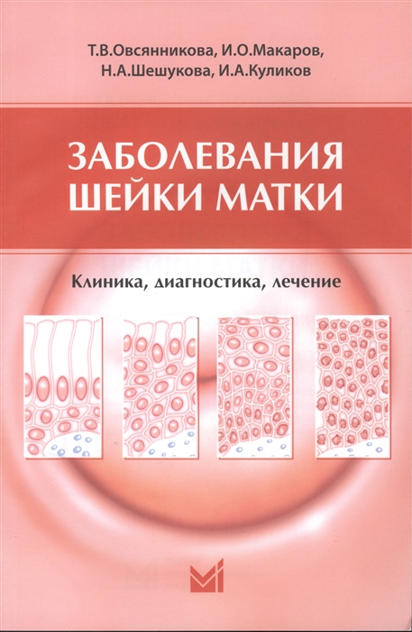 

Заболевания шейки матки Клиника диагностика лечение