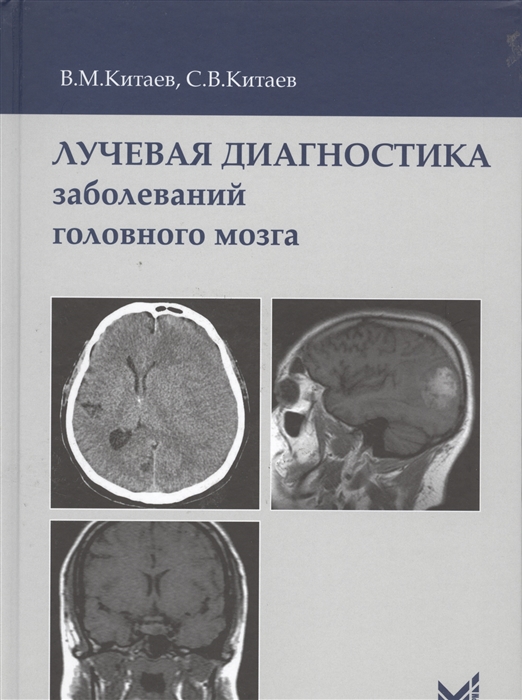 

Лучевая диагностика заболеваний головного мозга