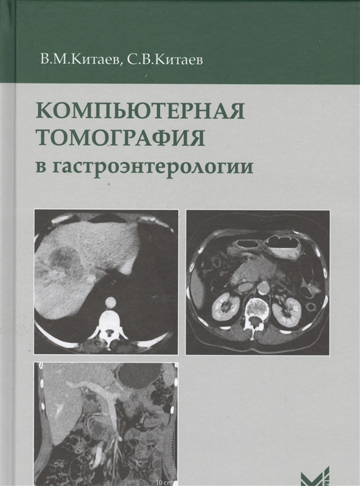 Китаев В., Китаев С. - Компьютерная томография в гастроэнтерологии Руководство для врачей