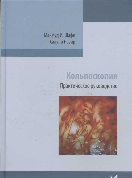 

Кольпоскопия Практическое руководство