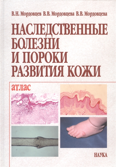 

Наследственные болезни и пороки развития кожи Клиника Морфология Лечение Атлас