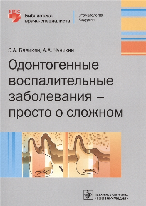 

Одонтогенные воспалительные заболевания - просто о сложном