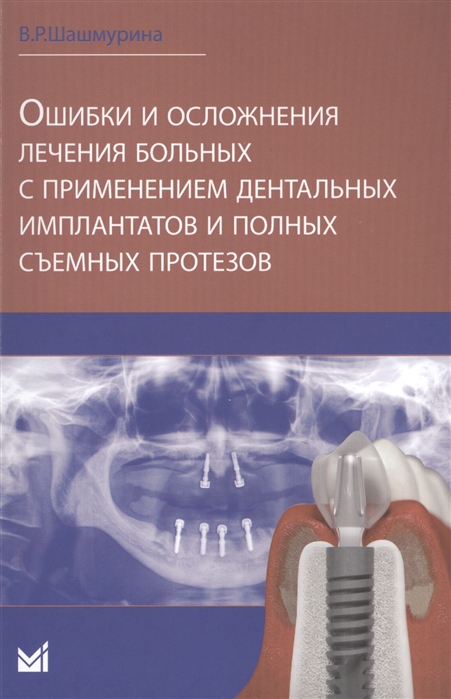 

Ошибки и осложнения лечения больных с применением дентальных имплентов и полных съемных протезов