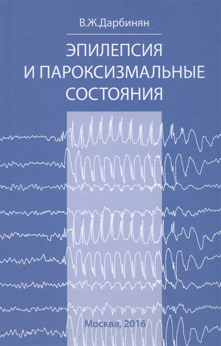 

Эпилепсия и пароксизмальные состояния Клиника диагностика лечение CD