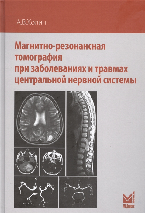 Холин А. - Магнитно-резонансная томография при заболеваниях и травмах центральной нервной системы