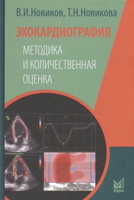 

Эхокардиография Методика и количественная оценка