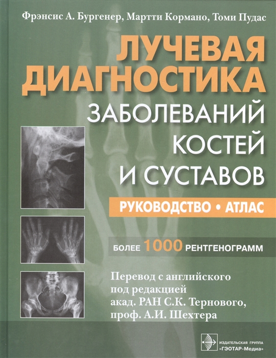 

Лучевая диагностика Заболевание костей и суставов Руководство Атлас