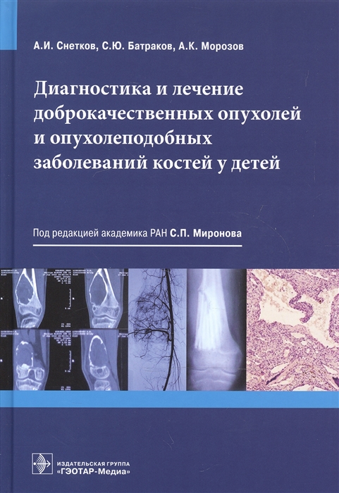 

Диагностика и лечение доброкачественных опухолей и опухолеподобных заболеваний костей у детей