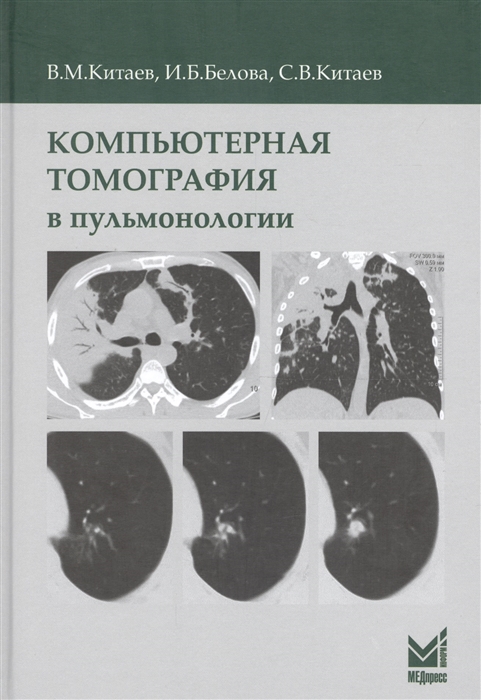 

Компьютерная томография в пульмонологии
