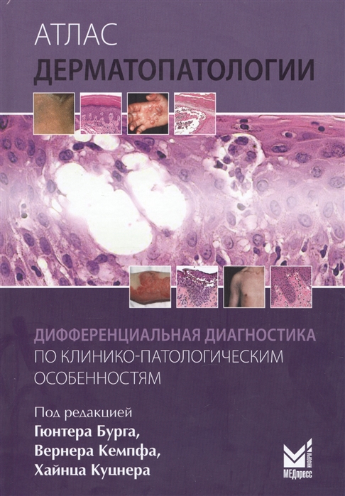 Бург Г., Кемпф В., Куцнер Х., ред. - Атлас дерматопатологии Дифференциальная диагностика по клинико-патологическим особенностям