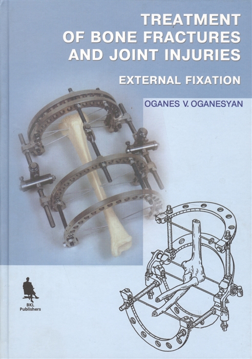 

Treatment of Bone Fractures and Joint Injuries External Fixation книга на английском языке