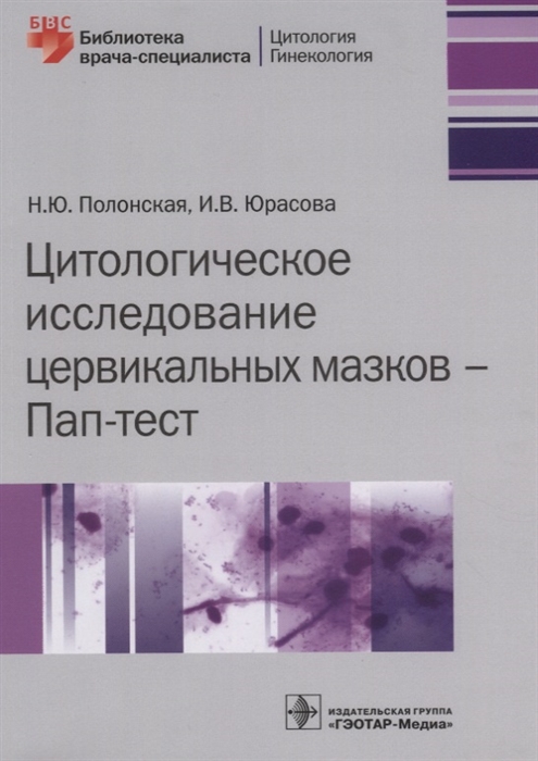 

Цитологическое исследование цервикальных мазков - Пап-тест