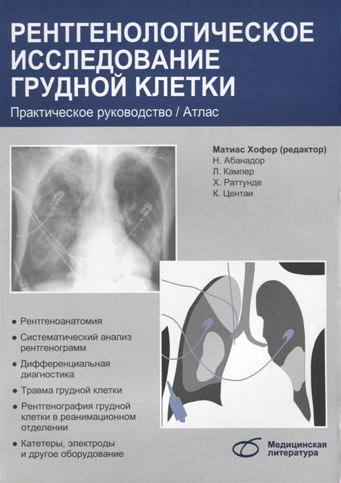 

Рентгенологическое исследование грудной клетки Практическое руководство Атлас