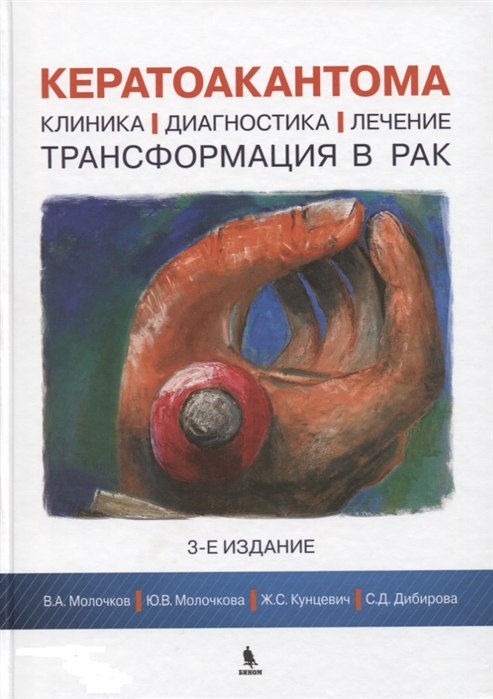 Молочков В., Молочкова Ю., Кунцевич Ж., Дибирова С. - Кератоакантома Клиника диагностика лечение трансформация в рак