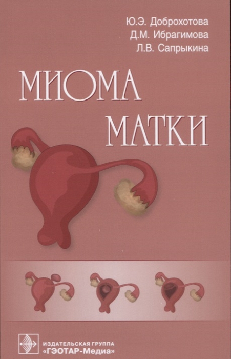 

Миома матки