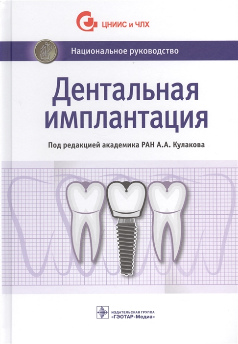 

Дентальная имплантация