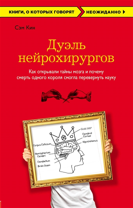 

Дуэль нейрохирургов Как открывали тайны мозга и почему смерть одного короля смогла перевернуть науку