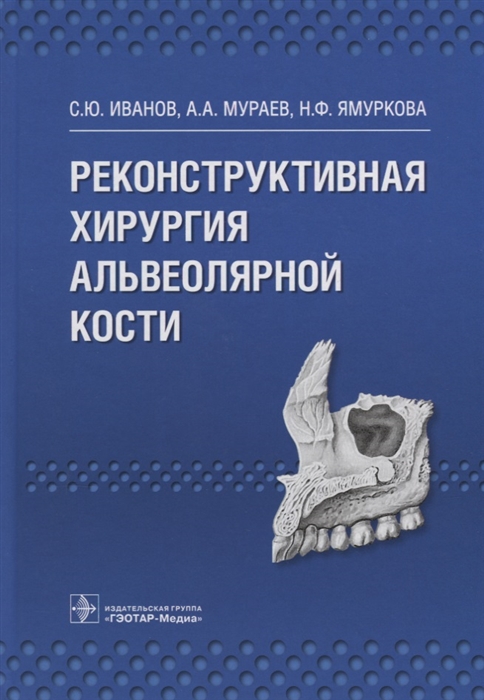 

Реконструктивная хирургия альвеолярной кости