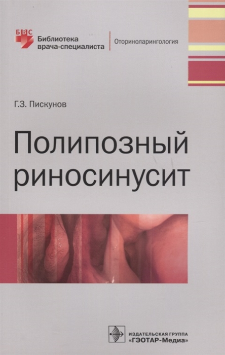 

Полипозный риносинусит