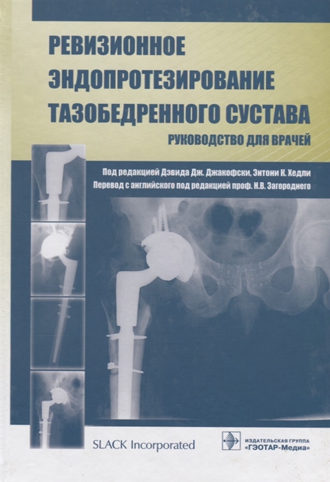 

Ревизионное эндопротезирование тазобедренного сустава Руководство для врачей