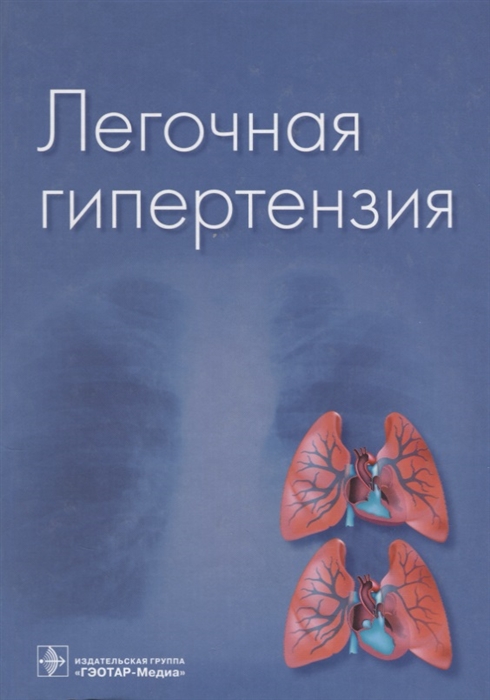 

Легочная гипертензия