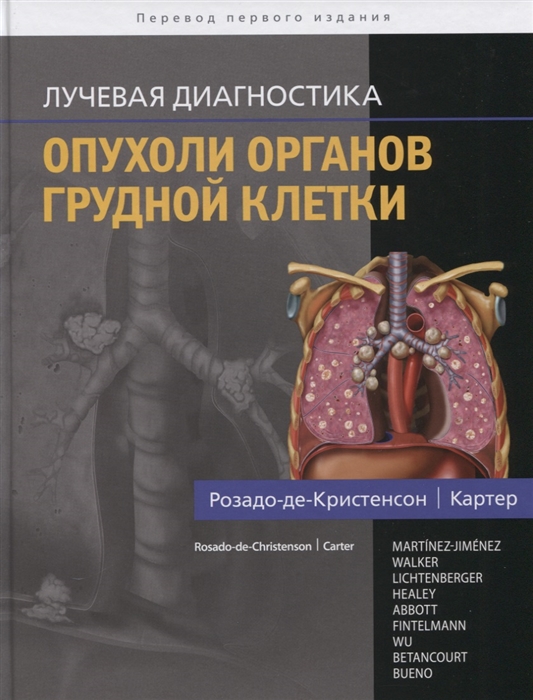 Розадо-де-Кристенсон М., Картер Б. и др. Лучевая диагностика Опухоли органов грудной клетки цена Розадо-де-Кристенсон М., Картер Б. и др. Лучевая диагностика Опухоли органов грудной клетки цены онлайн