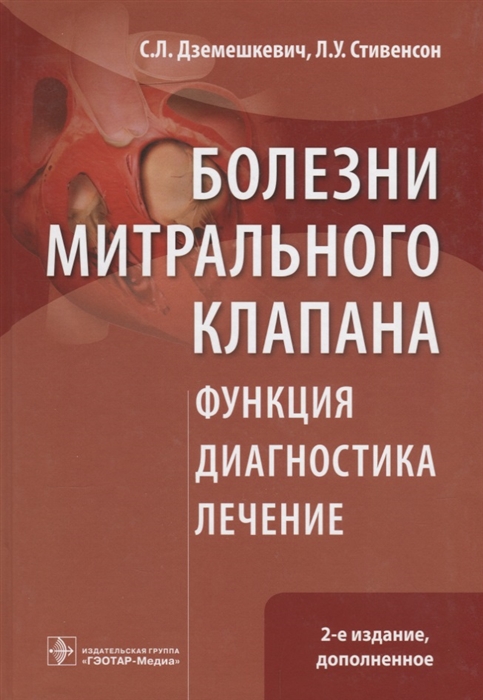 

Болезни митрального клапана Функция диагностика лечение