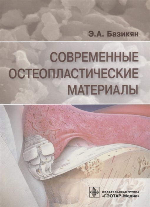 

Современные остеопластические материалы