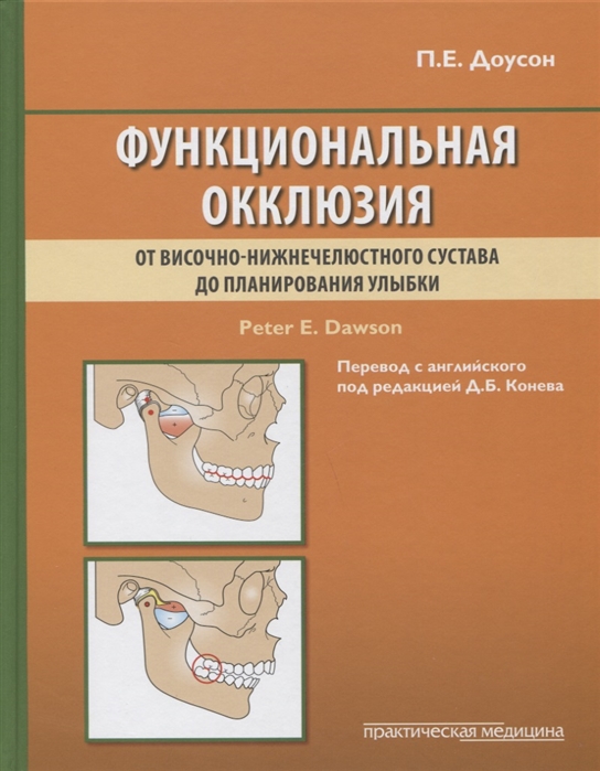 

Функциональная окклюзия от височно-нижнечелюстного сустава до планирования улыбки