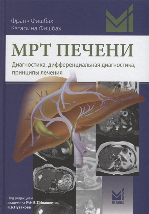 Фишбах Ф., Франк К. - МРТ печени Диагностика дифференциальная диагностика принципы лечения