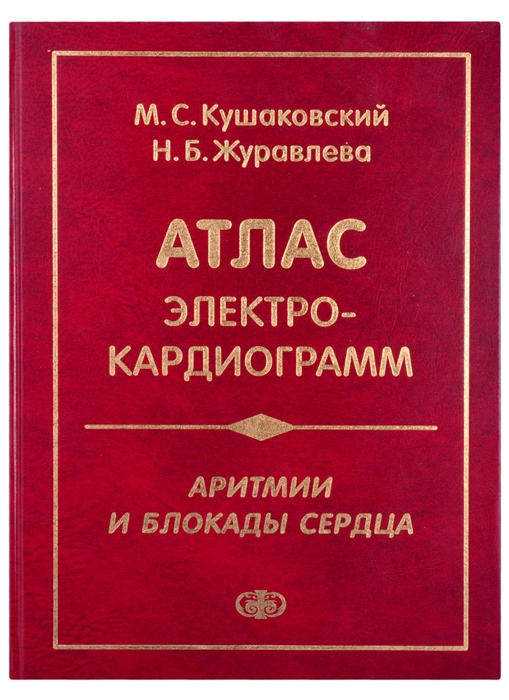 

Атлас электрокардиограмм Аритмии и блокады сердца