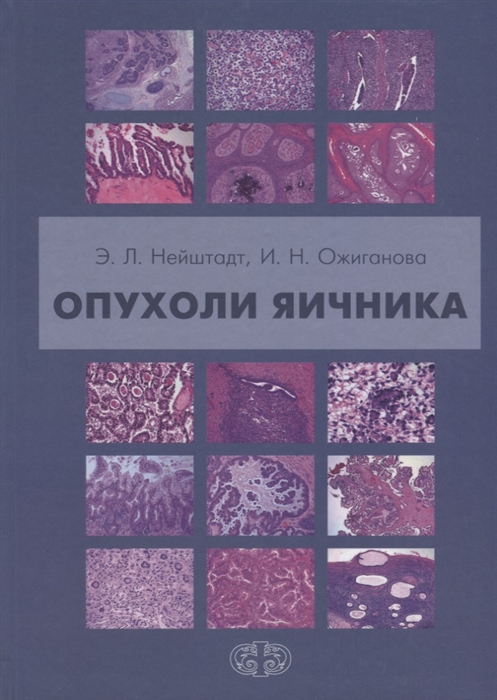

Опухоли яичника