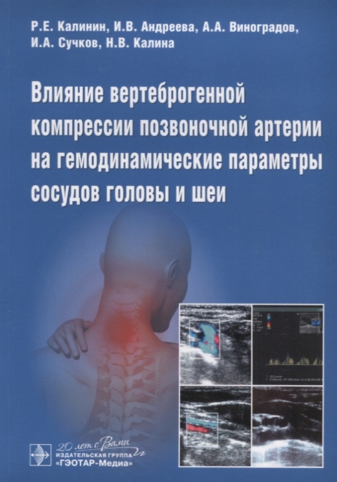 

Влияние вертеброгенной компрессии позвоночной артерии на гемодинамические параметры сосудов головы и шеи