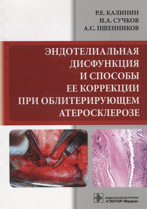 Калинин Р., И.А. Сучков, Пшенников А. - Эндотелиальная дисфункция и способы ее коррекции при облитерирующем атеросклерозе