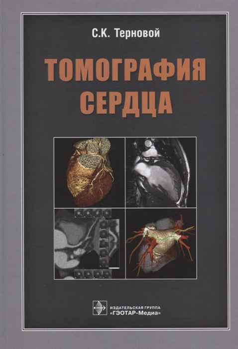Терновой С. - Томография сердца