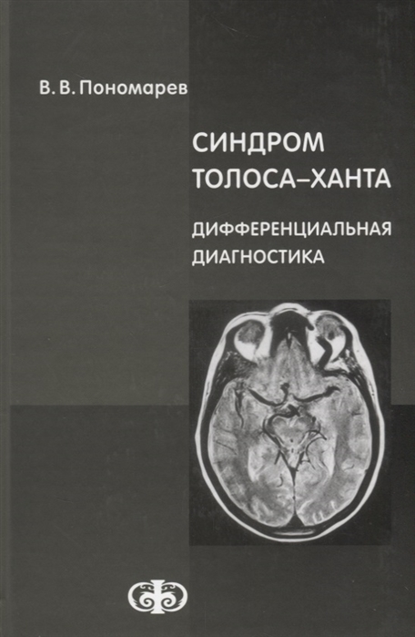 Пономарев В. - Синдром Толоса-Ханта Дифференциальная диагностика