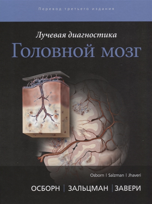 

Лучевая диагностика Головной мозг